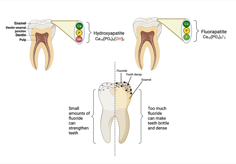 small amounts of fluoride can strengthen teeth but too much can make them brittle and dense