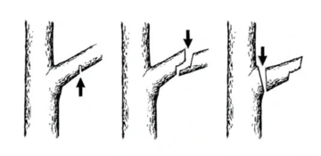 illustration of the three cuts necessary to remove large limbs